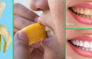 How to whiten the teeth using banana peels