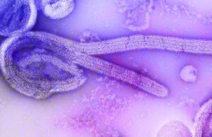New Ebola case detected in eastern DRC