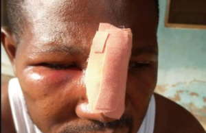 JHS 3 pupil who allegedly assaulted teacher over homework remanded